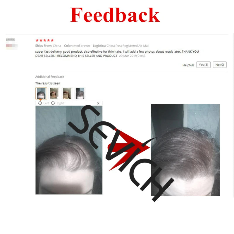 Keratin Hair Loss Building Fiber Hair Growth Fiber Refill Hair Loss Concealer