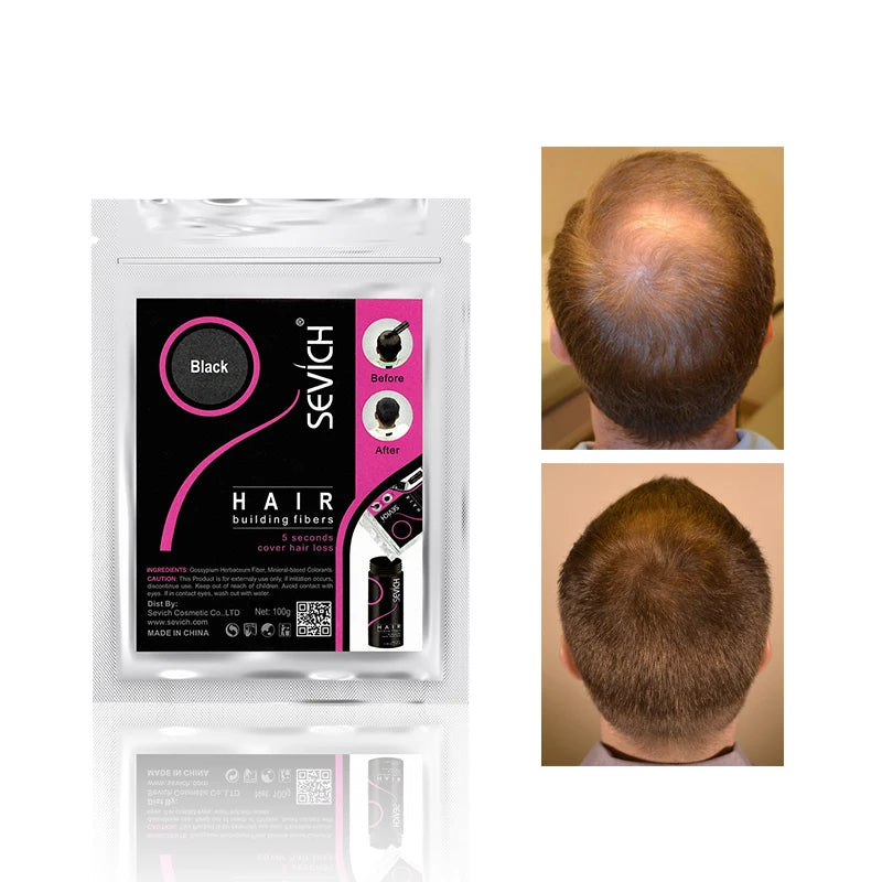 Keratin Hair Loss Building Fiber Hair Growth Fiber Refill Hair Loss Concealer