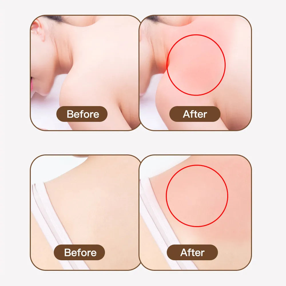 Natural Bamboo Massage Sticks Wood Therapy