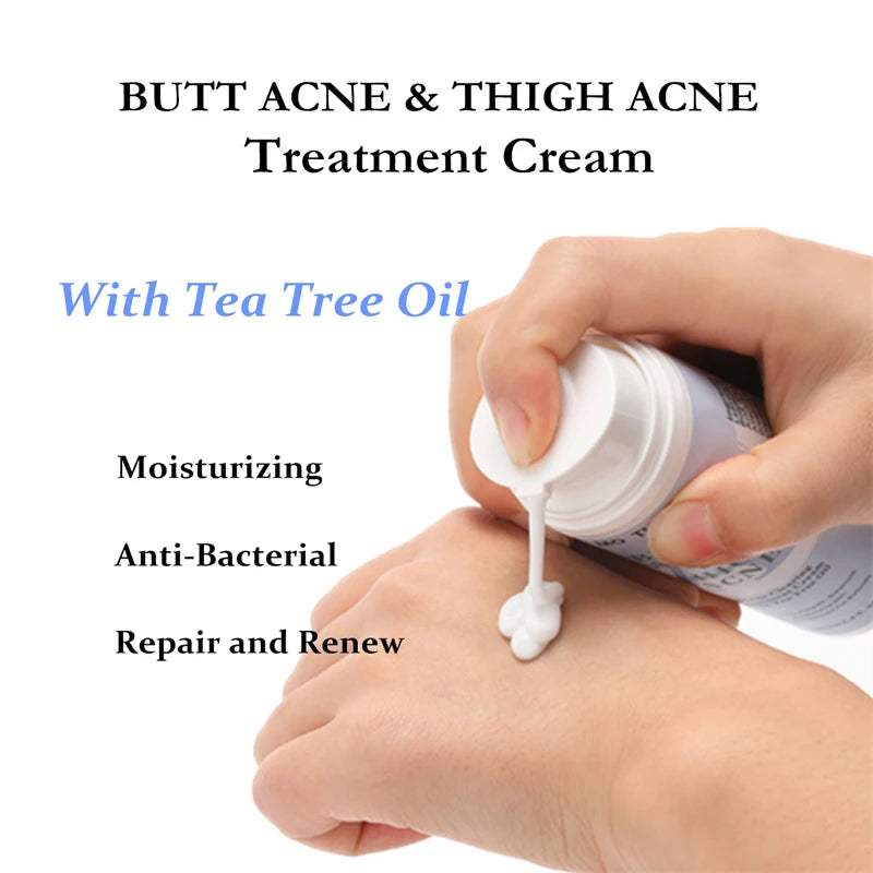 Acne Cream Tea Tree Oil Remove Hip Thigh Acne Moisturizes Smooth Skin  Body Care Cream